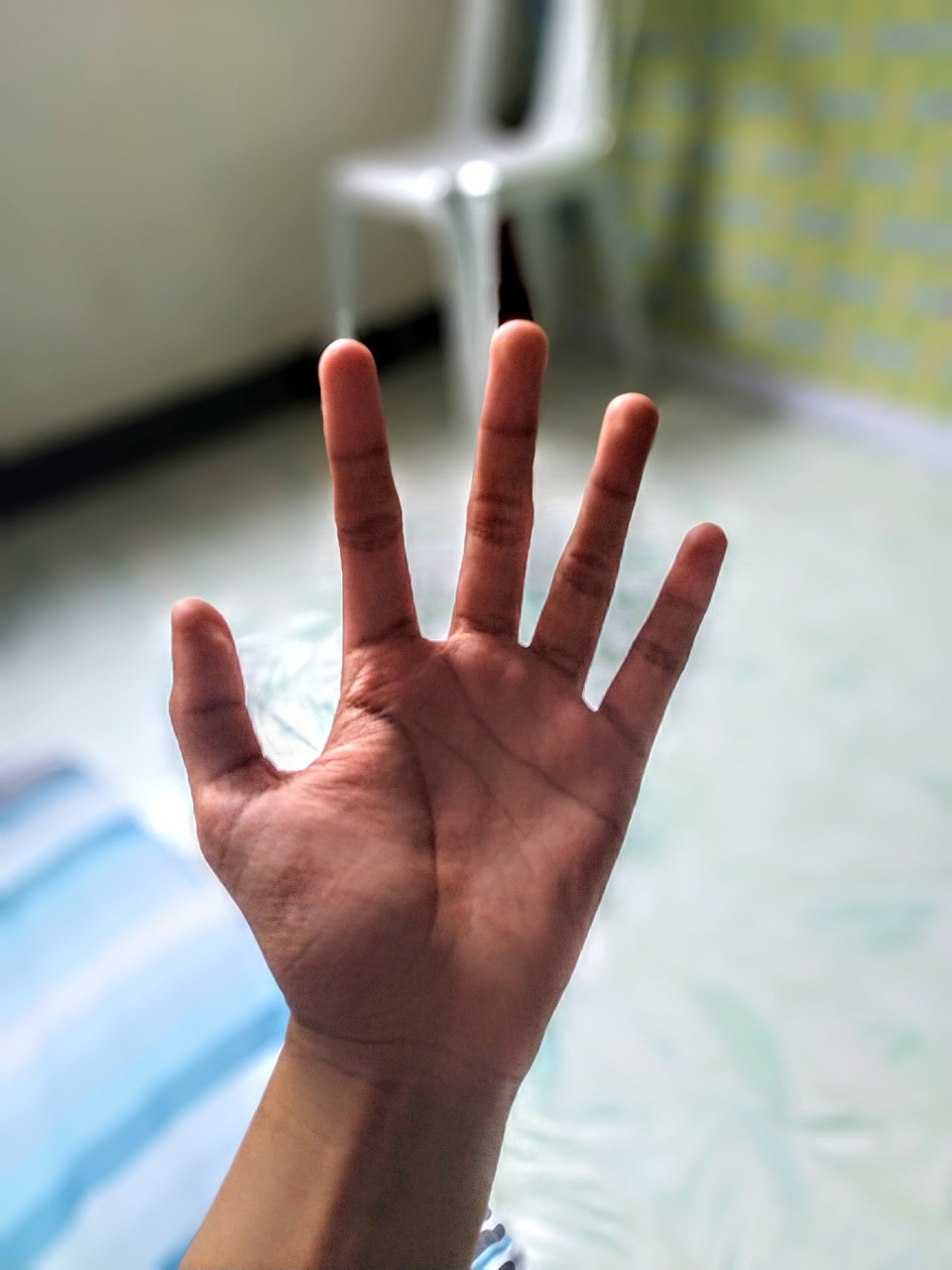 食指中指无名指麻是什么原因	食指中指无名指麻可能是长期姿势不良