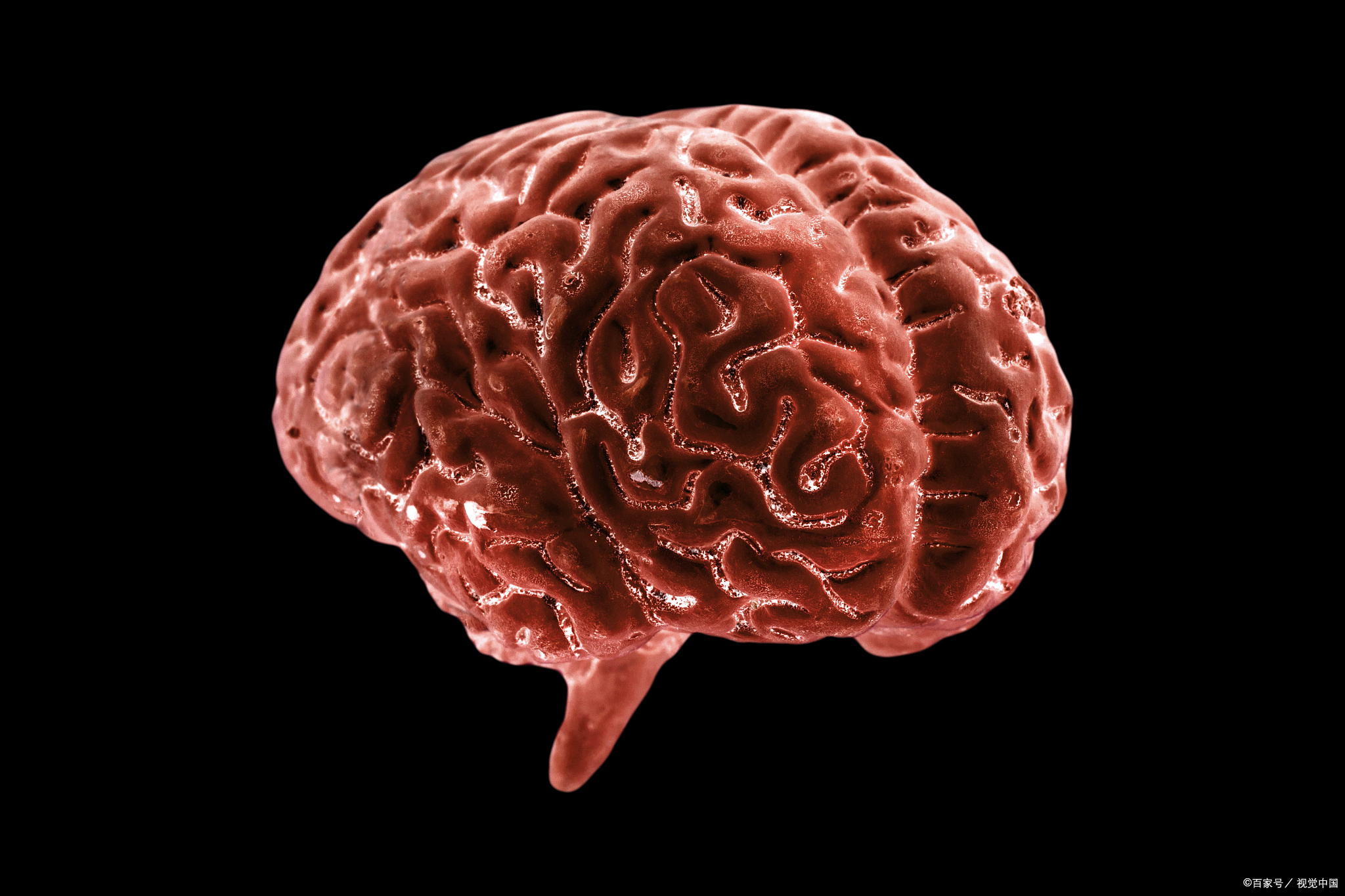 21岁大学生脑出血后700天的奇迹:年轻人脑出血的诱