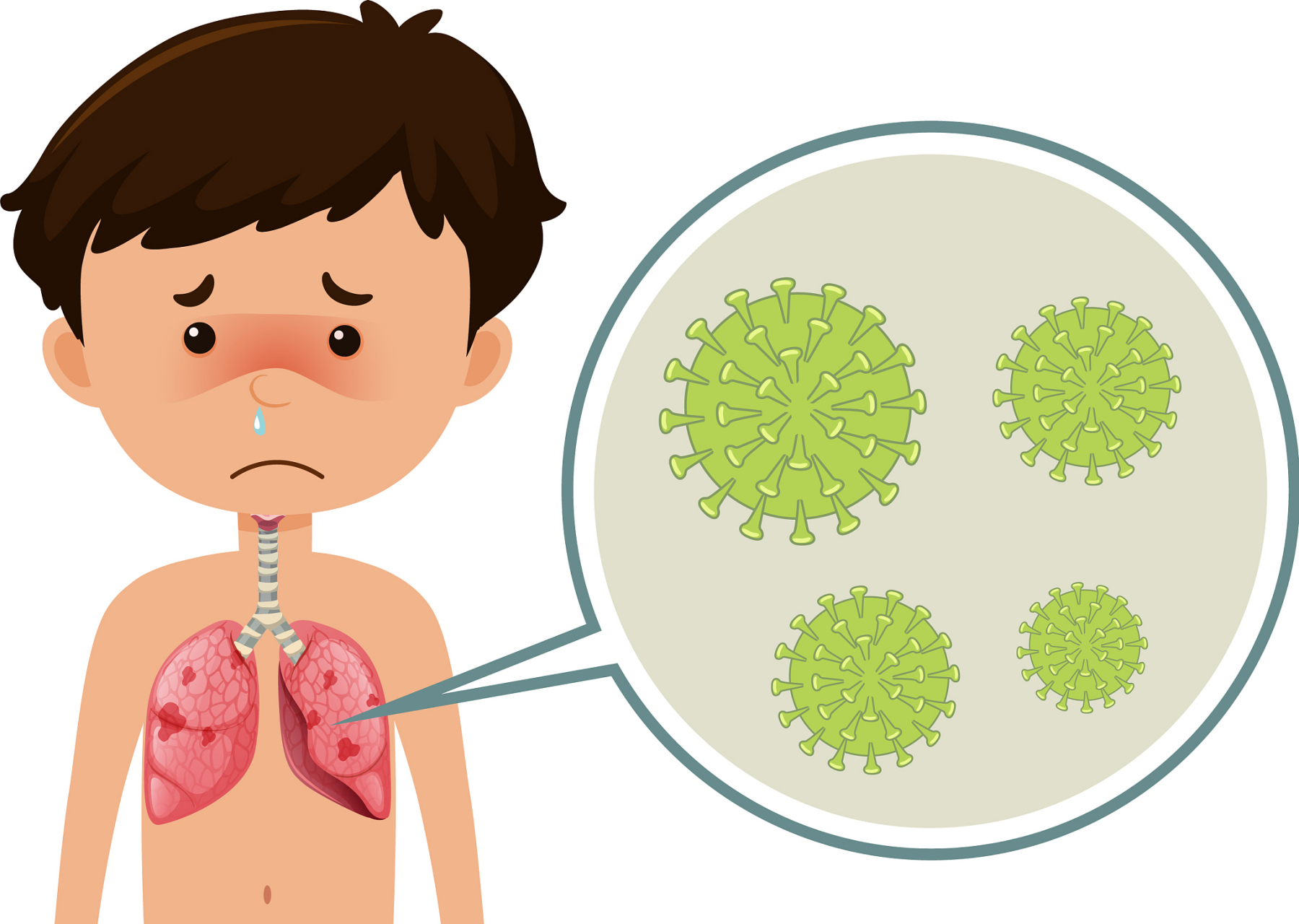 呼吸道感染的并发症和预后  呼吸道感染可能引发一些并发症,并且预后