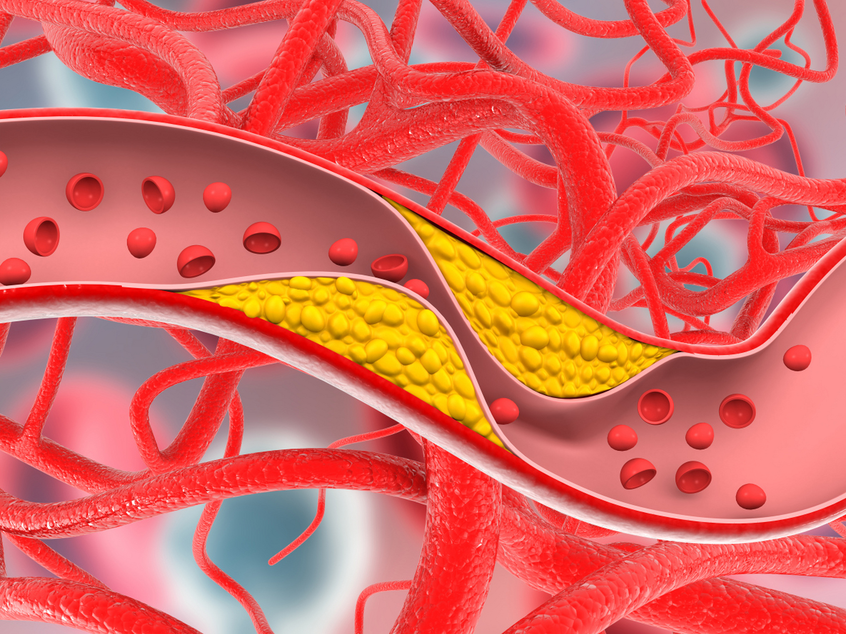 心血管疾病的预防,爱护心脏,从生活方式开始 心血管疾病是全球范围内
