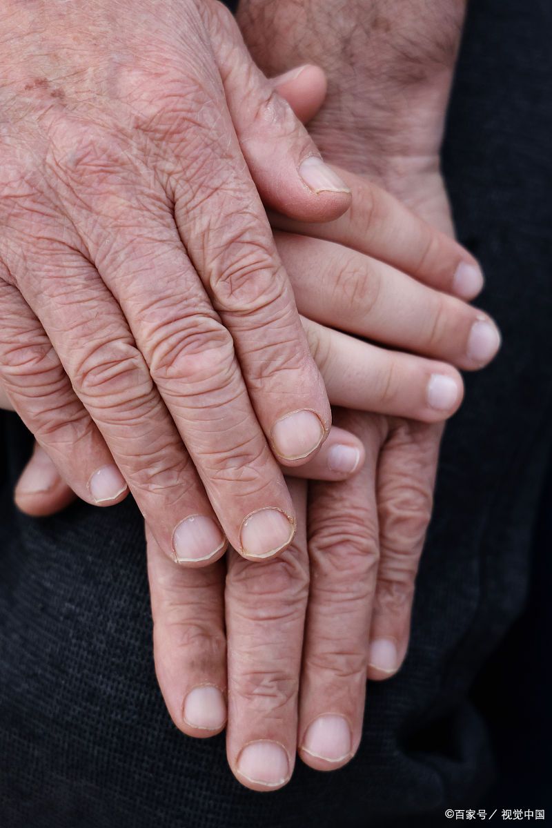 综上所述,老年人剪指甲速度快是否是好事,需要具体分析原因