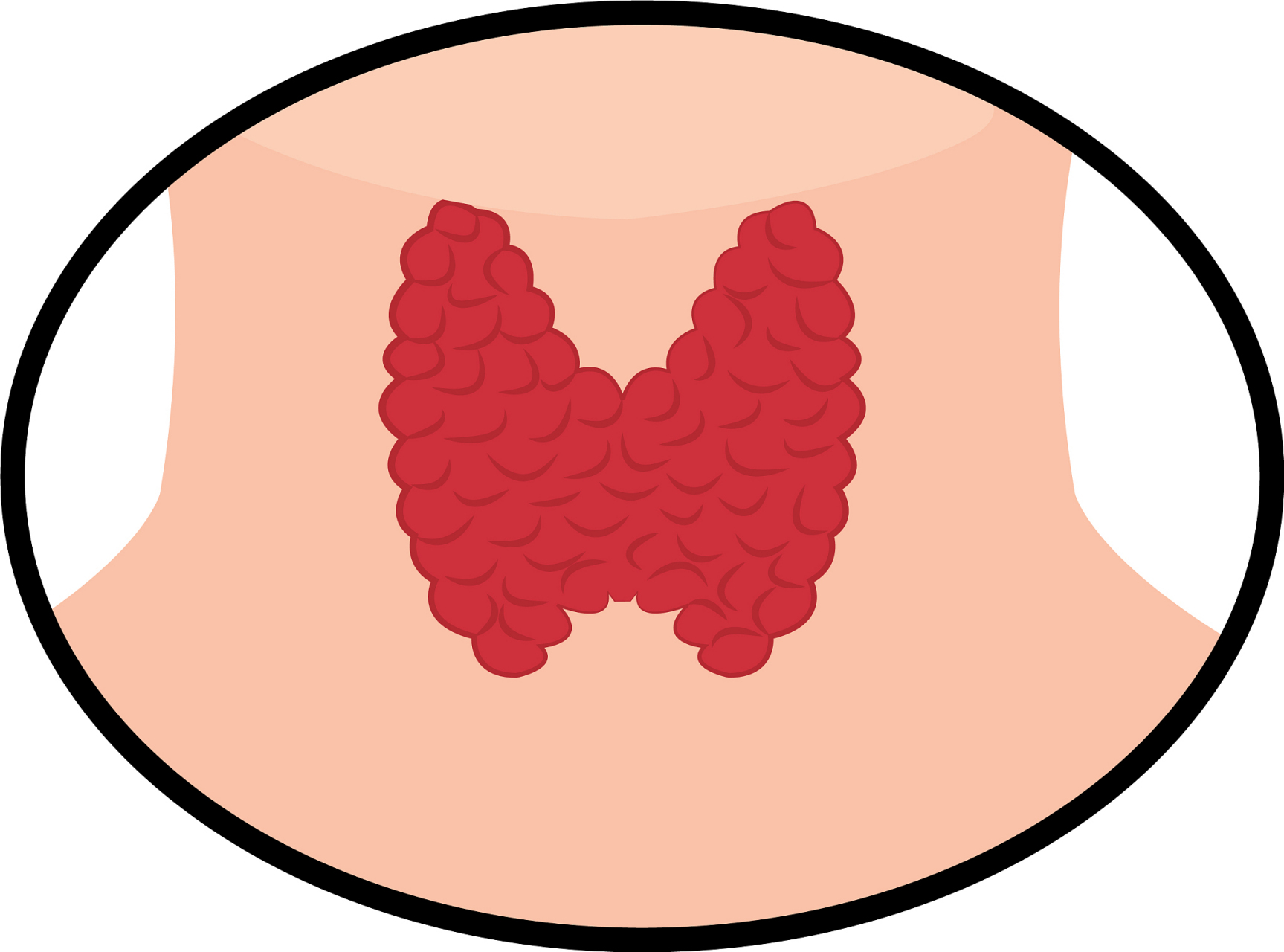 正常甲状腺是没有结节的,甲状腺结节一般小于1cm,且没有恶性趋向的