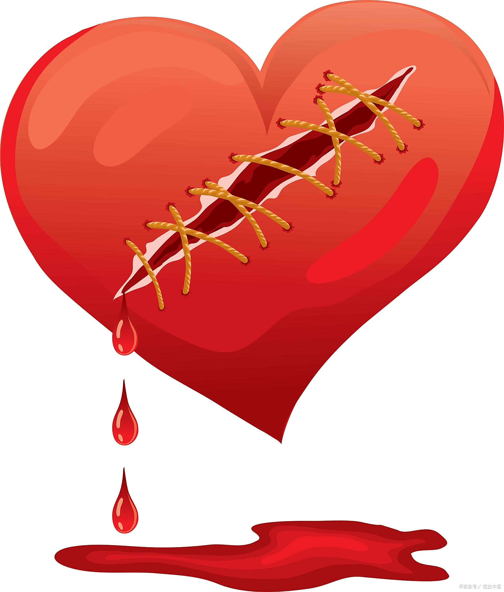 虐心爱情是一种痛苦的情感经历,不仅带来生理上的痛苦,更让人在心理上