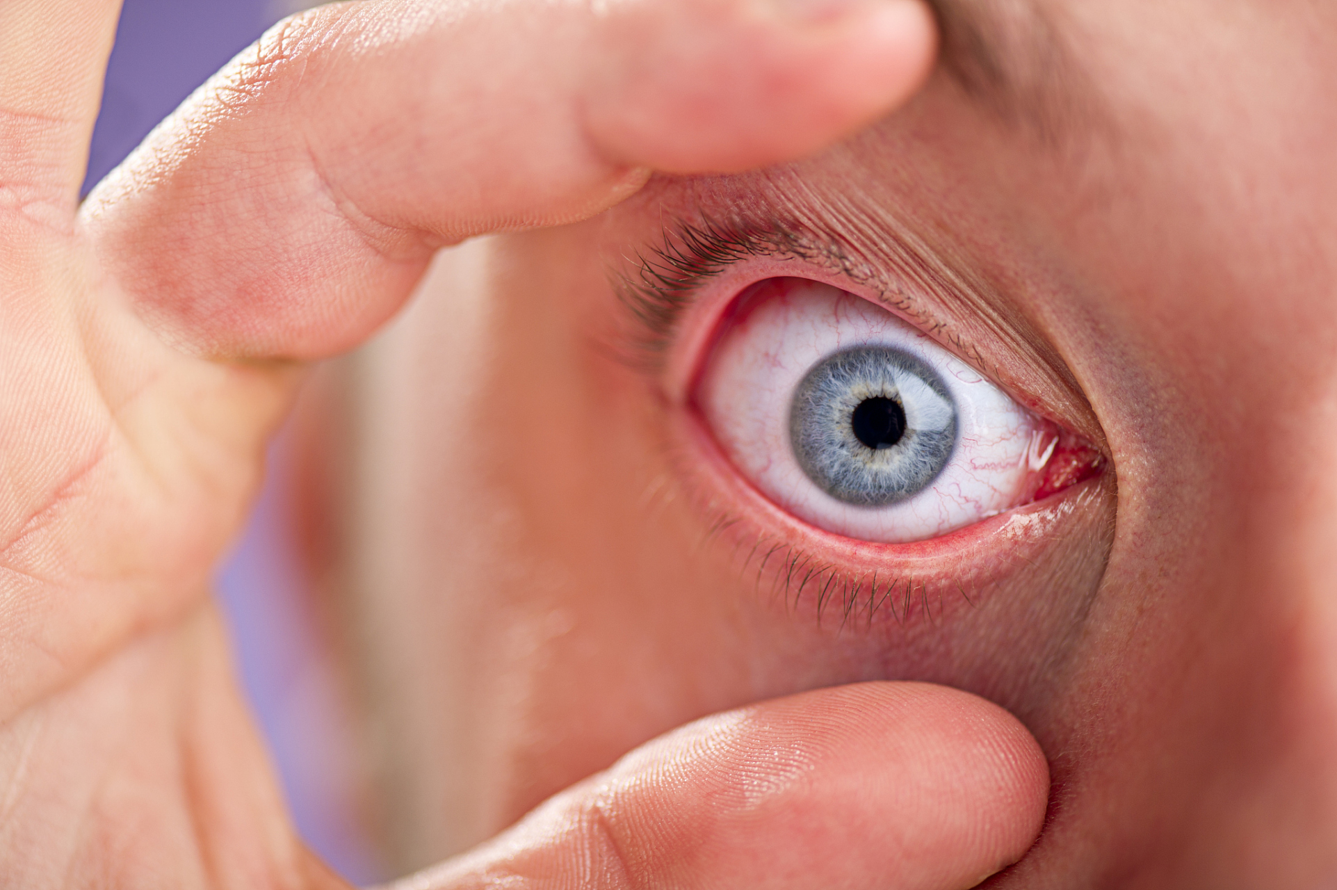 不可掉以轻心 眼睛是人体的窗户,但也是一个容易受到伤害的部位