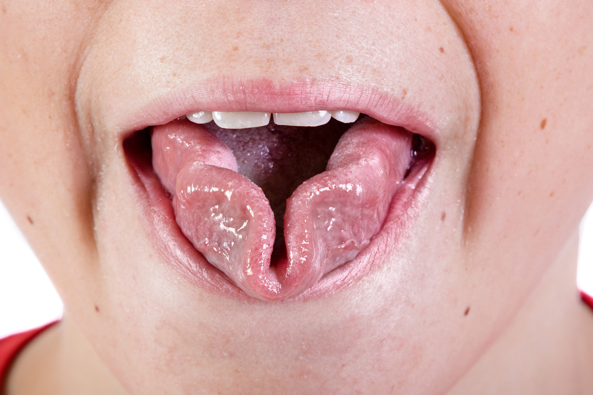 舌头尖起泡是什么原因	舌尖起泡,有可能是因为上火造成的.