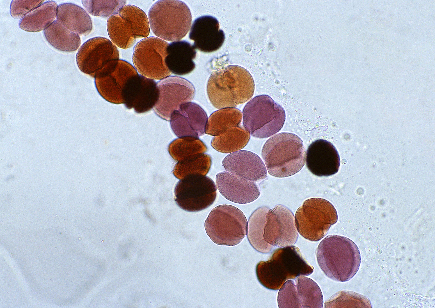 历史上的今天,合成结晶牛胰岛素