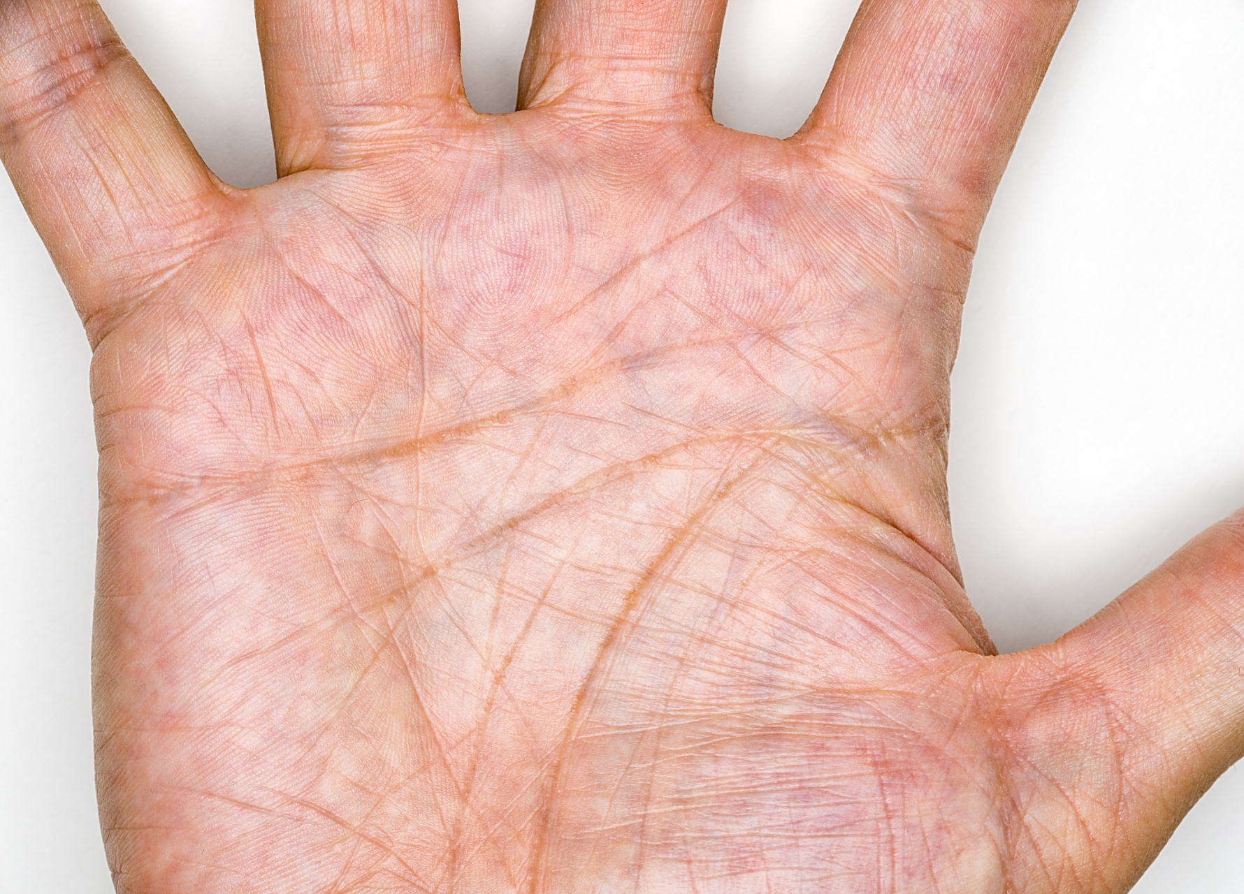 虽然我们的掌纹基本固定不变,但细微的皮肤纹理的确会发生一些变化.