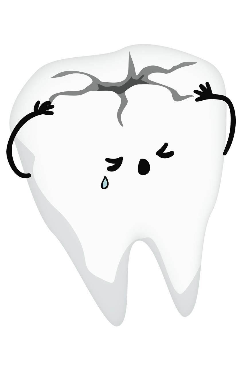 预防乳牙蛀牙的关键,这五点要记住  乳牙蛀牙是一种常见的儿童口腔