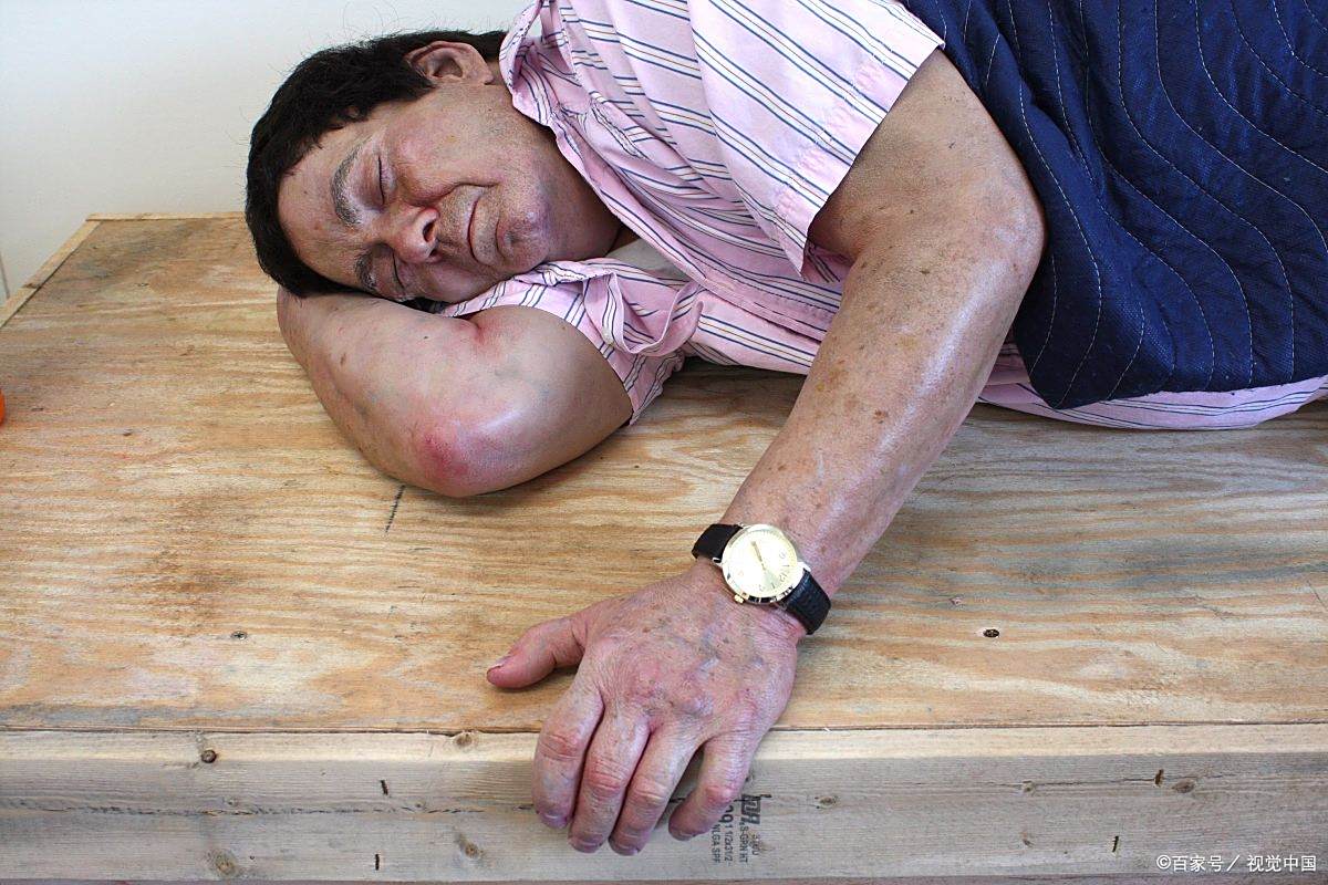 活性,同时也可以适当的进行一些力量训练,比如巳颂迦鄙倌撇 症图片