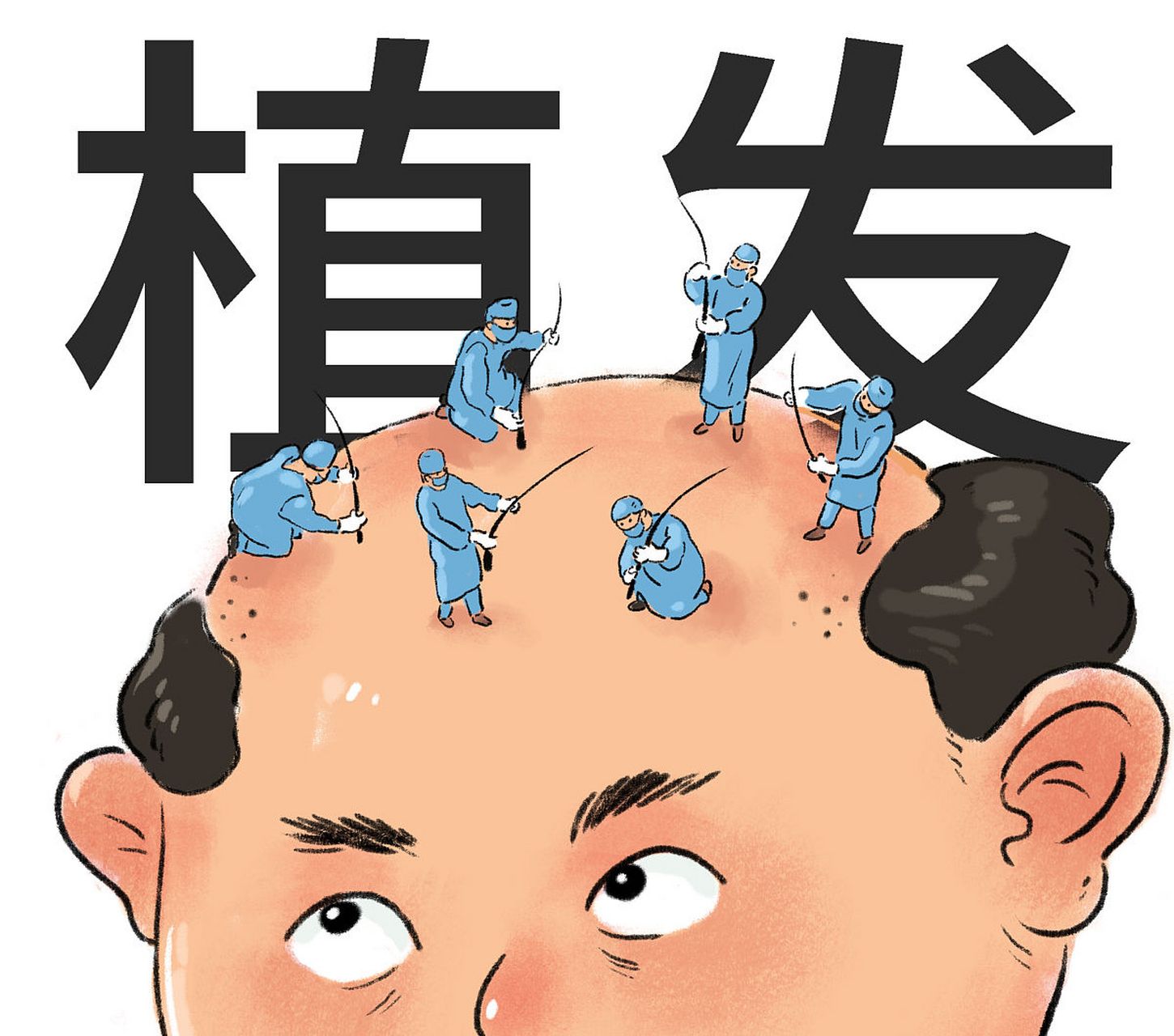 美人尖植发的适用人群 #不秃头的正确打开方式#  美人尖的适合人群