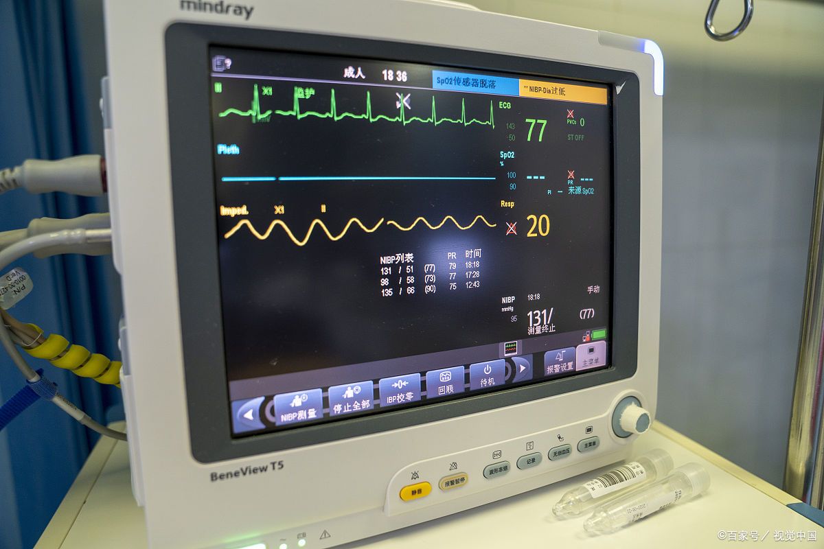 心脏监测仪图片怎么看图片