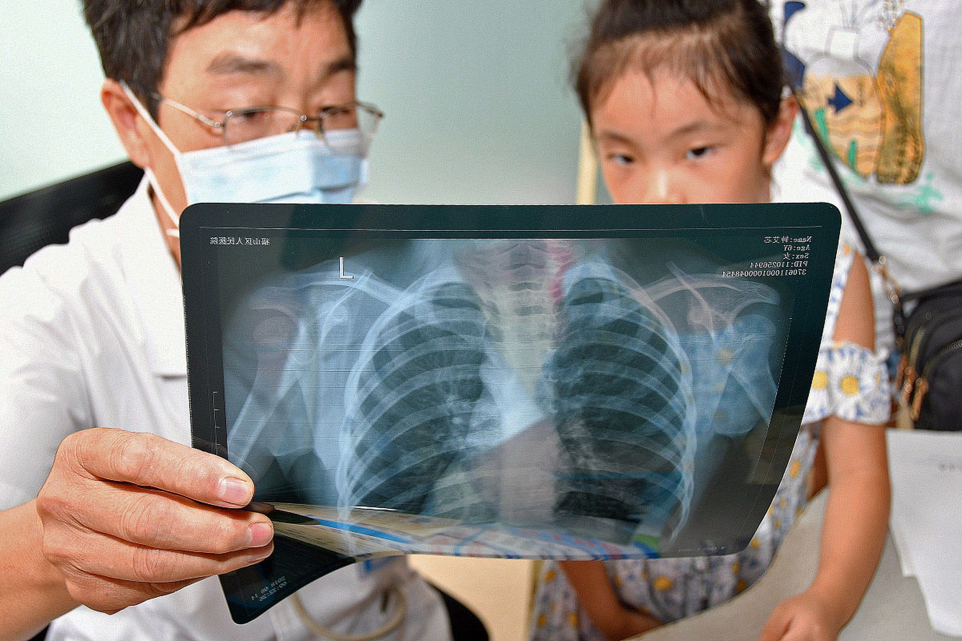 最近有个妈妈带她的孩子去拍胸片,结果发现是小孩在操作!太有趣了!