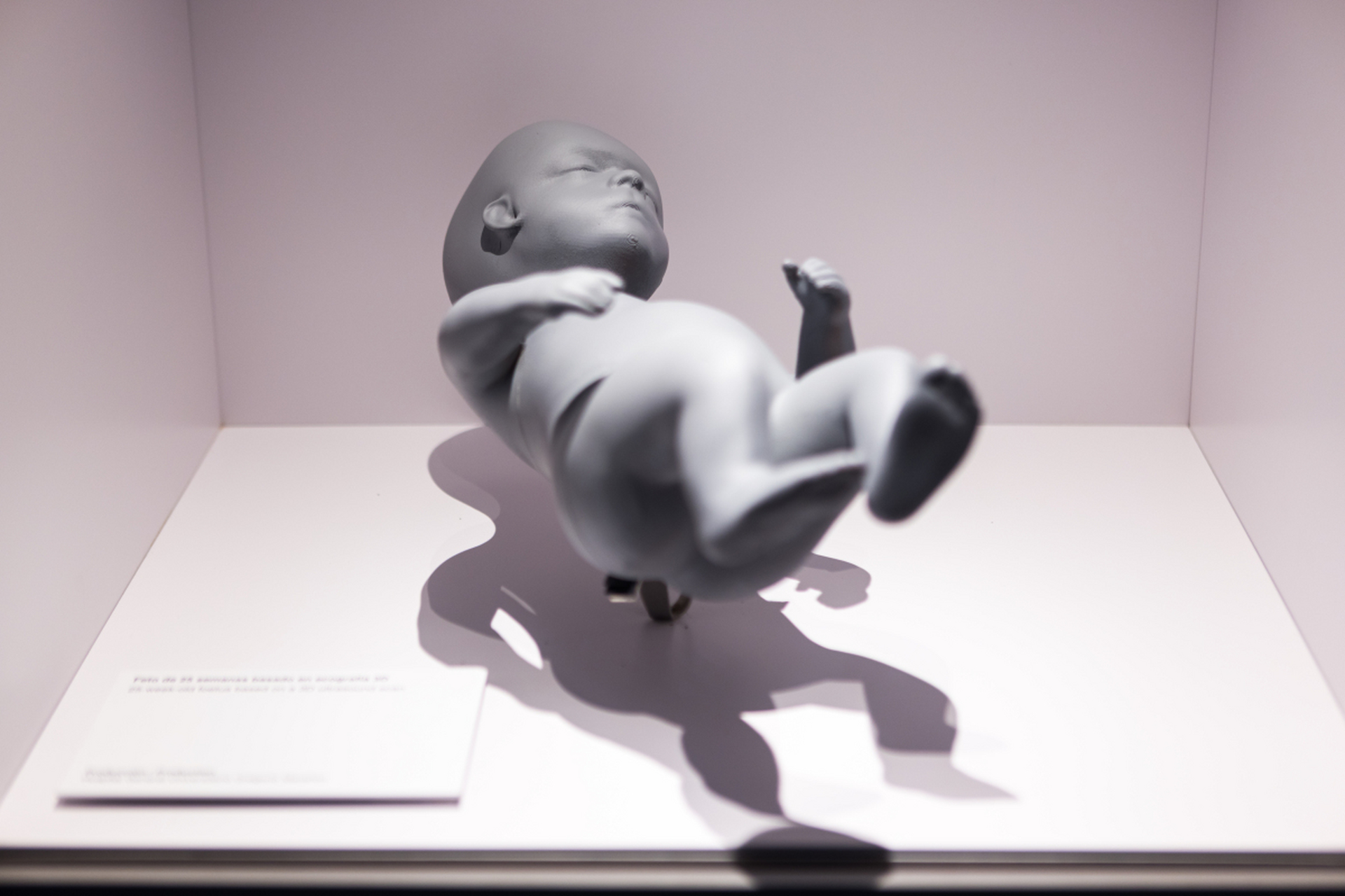 郑鸿逵是郑成功的叔叔.  他晚年得了痿痺之疾,手脚不能动弹,没有感觉.