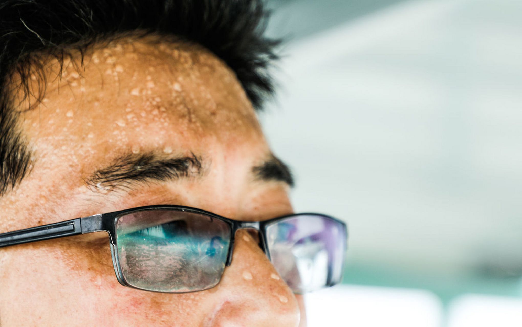 【这8个部位爱出汗,是疾病的前兆】  1,浑身出汗