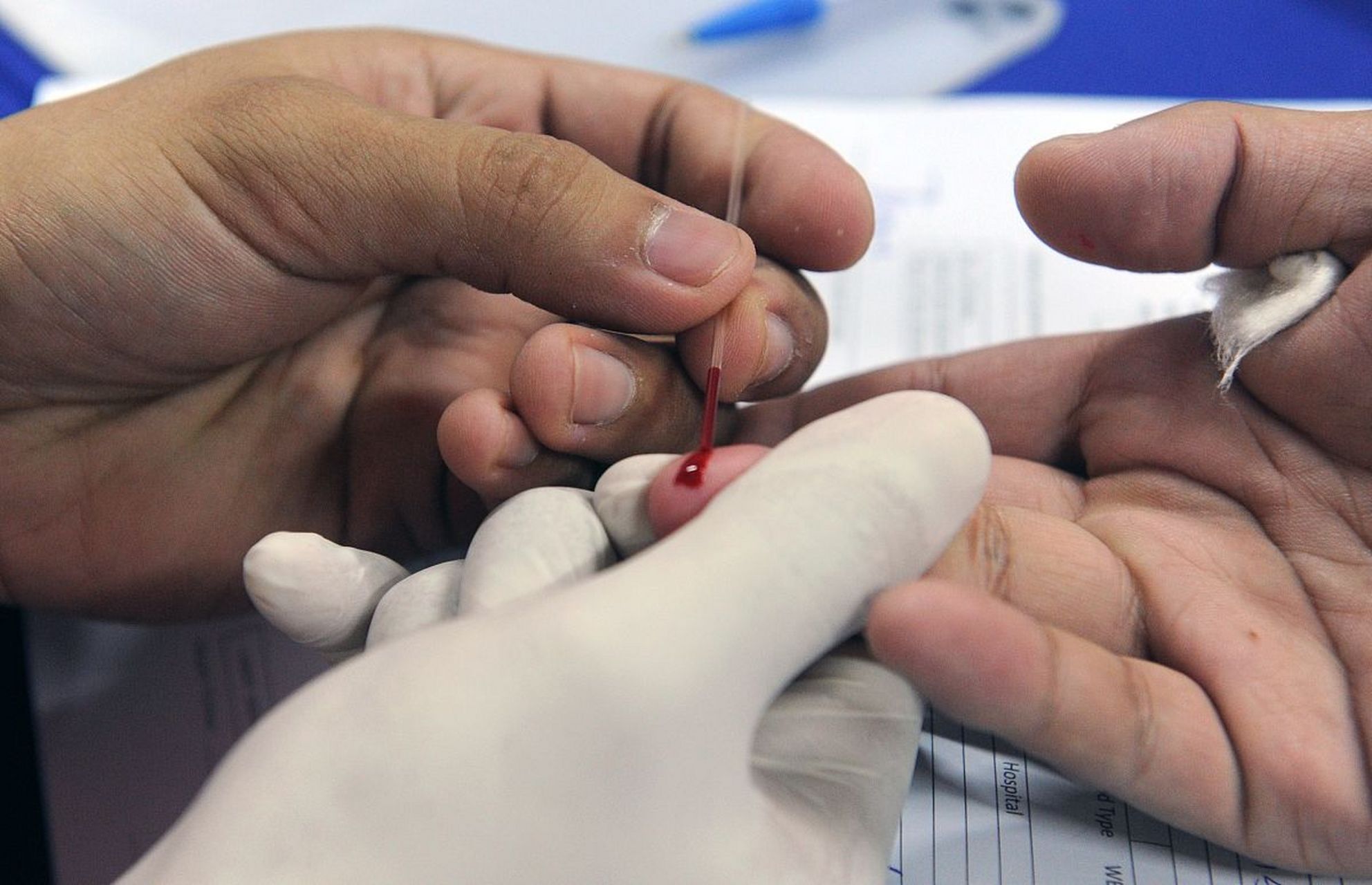 警惕中风# 中风后扎手指放血对吗?