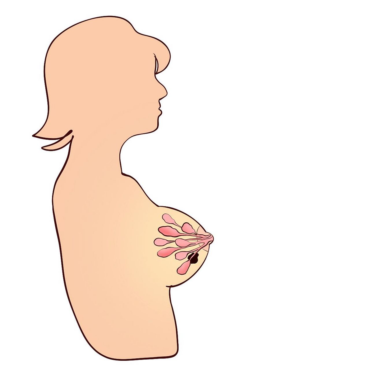 动态连更挑战#女性大部分都有乳腺增生,如果不注意