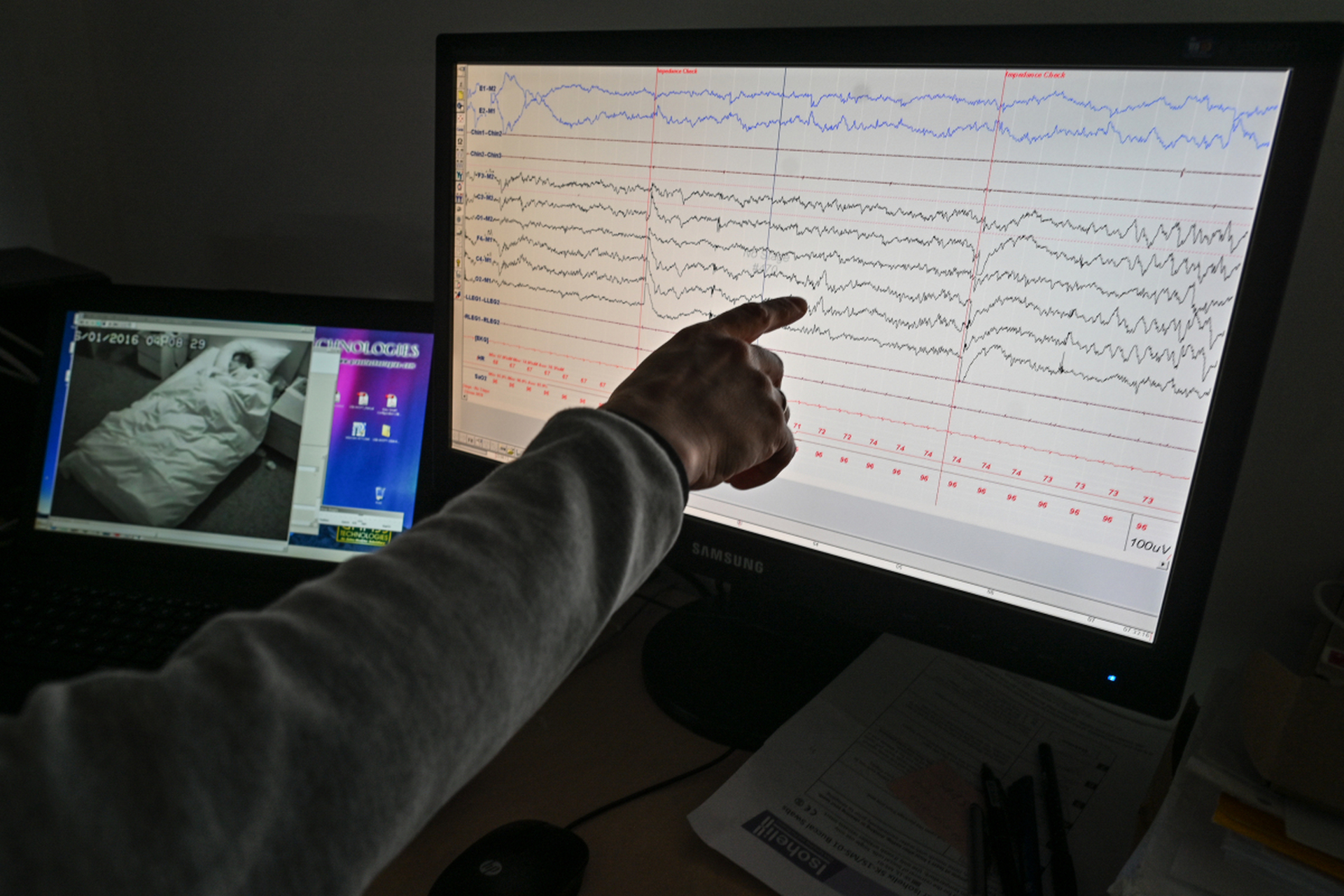 【健康科普】动态脑电图主要检查什么? #脑电图#  动态脑电图一般用于