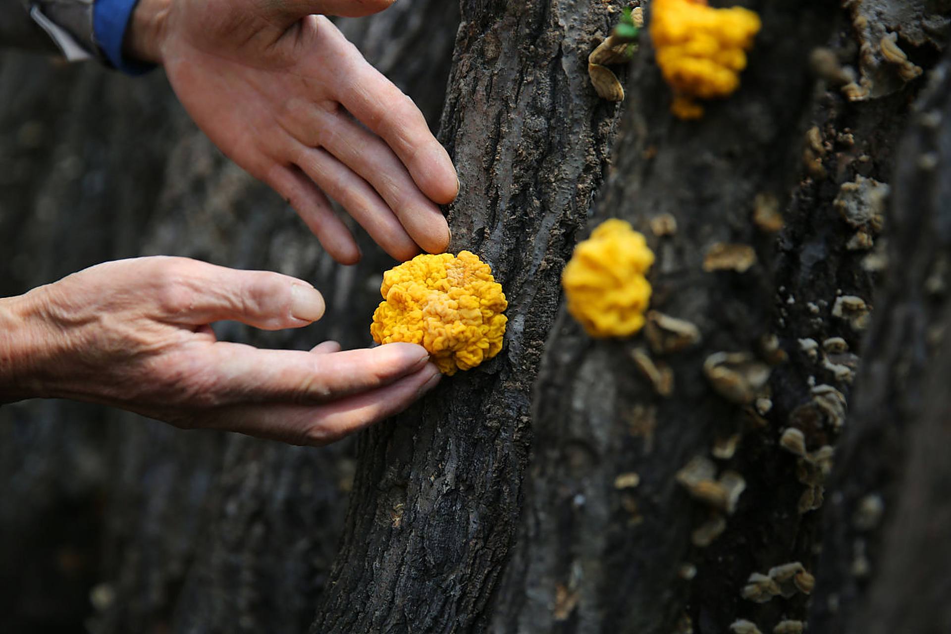 肿瘤和木耳的故事: 1,潮湿的木头长木耳,寒湿的体质长肿瘤; 2,木耳摘