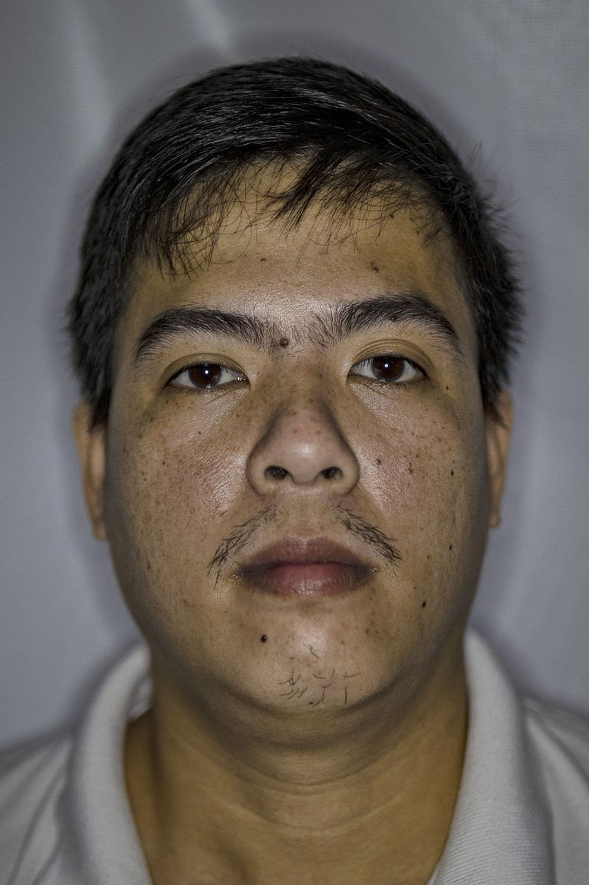 当肝脏功能出现异常的时候,嘴唇一般会出现发黑的症