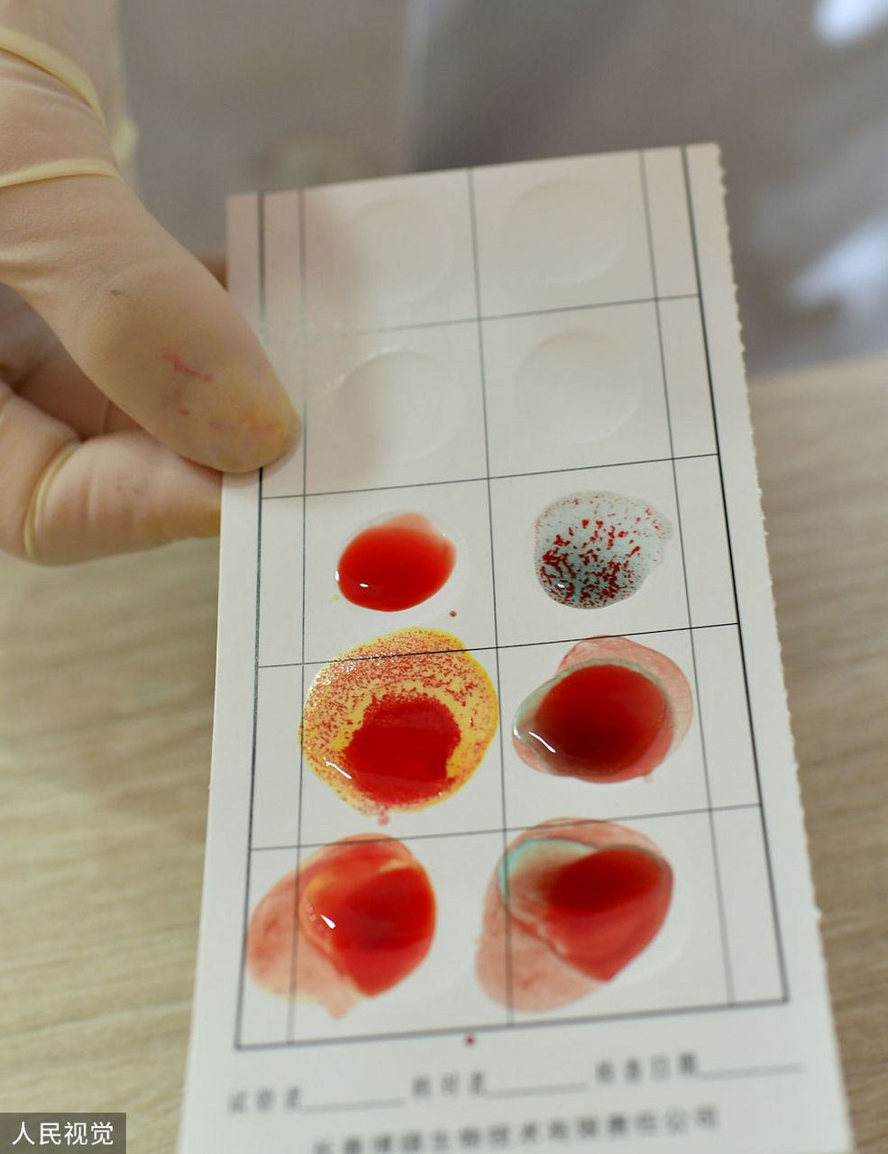 光听名字你就知道这种血型一定很稀有.恐龙血是在哪里发现的?