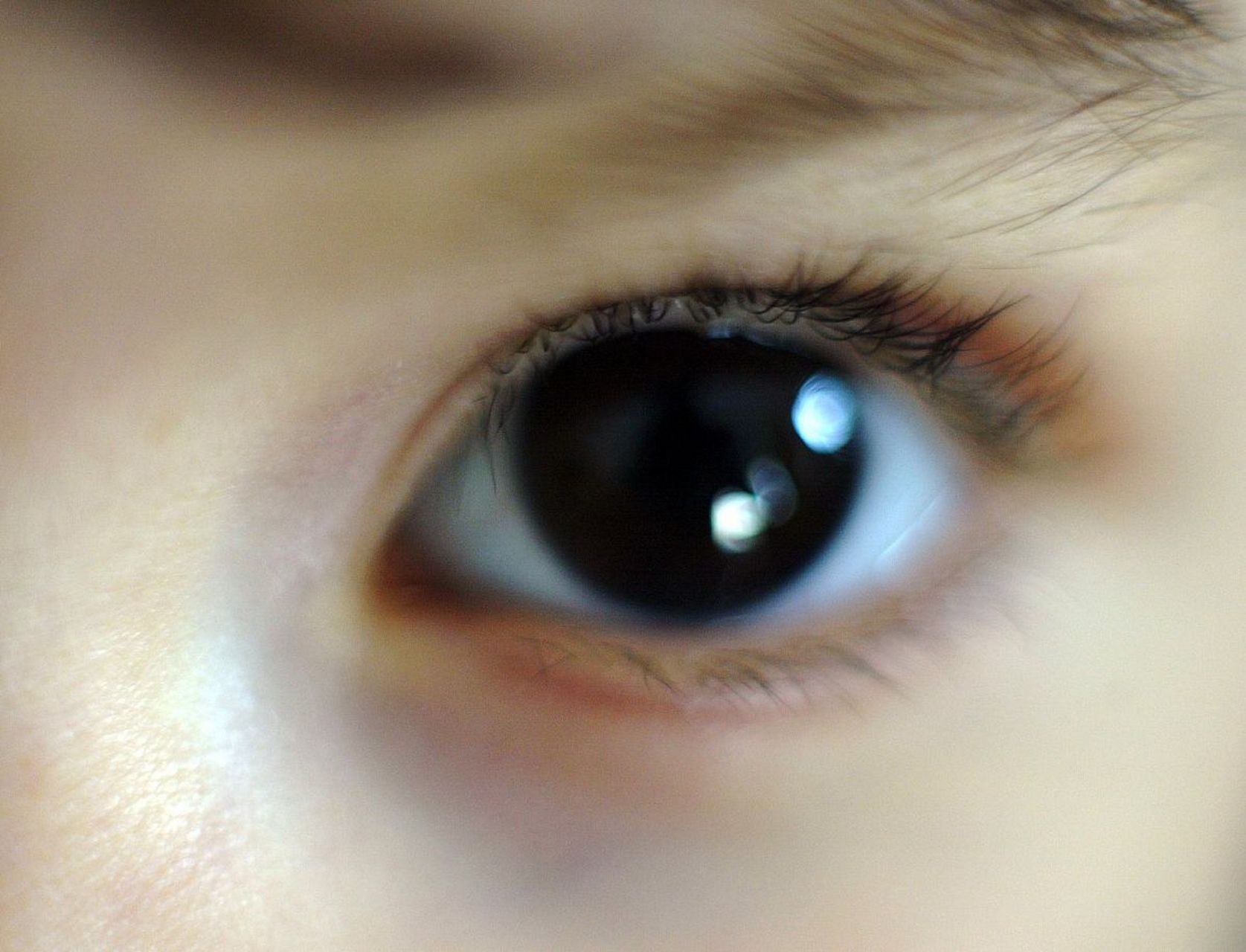 四,眼睛和眼镜 成像原理: 从物体发出的光线经过晶状体等一个综合的凸