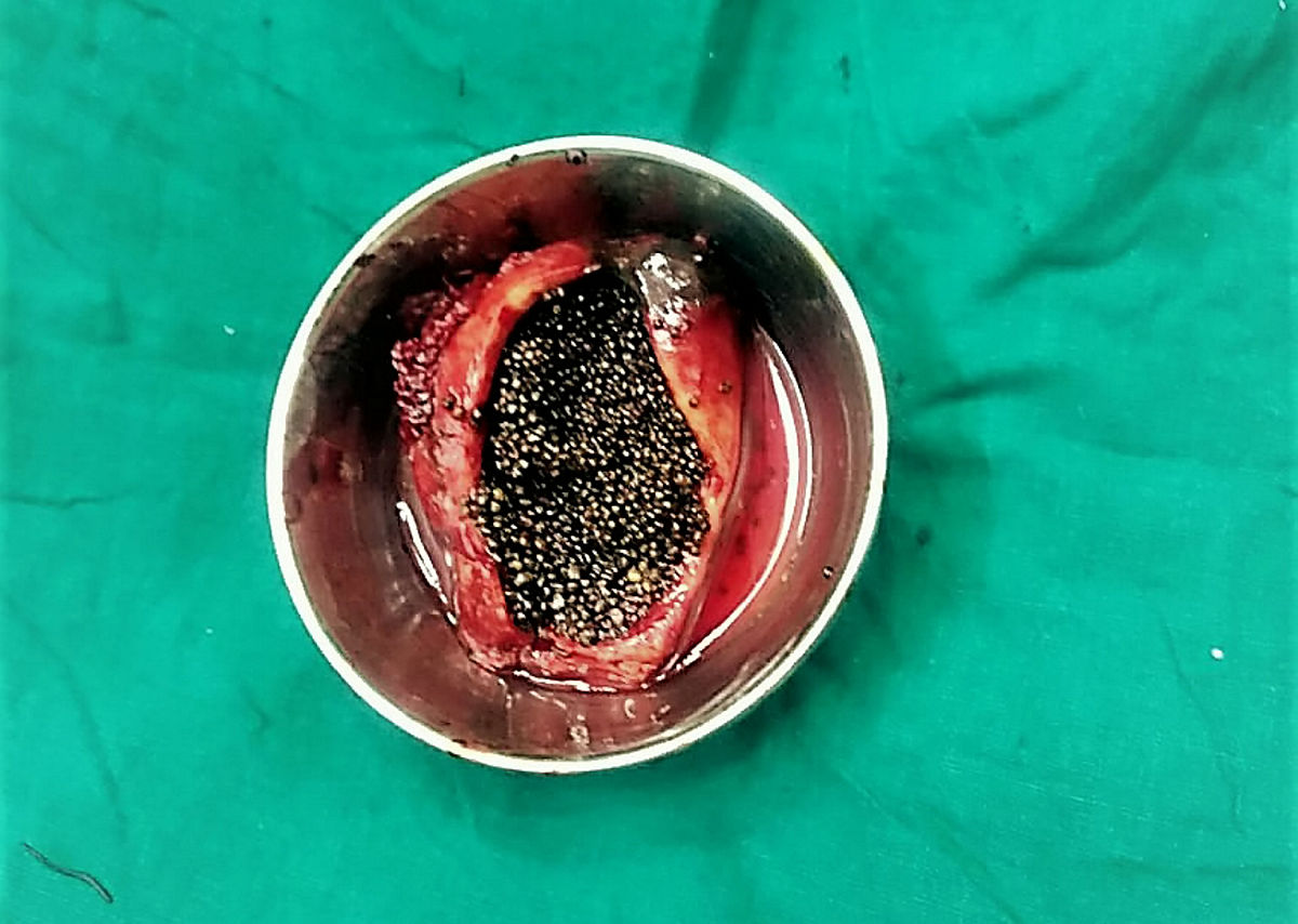 胆汁是胆囊里制造出来的吗?